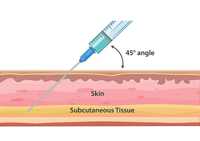 Skin Injection Illustration design graphic design illustration injection layers medical science skin