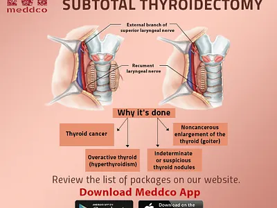 Subtotal Thyroidectomy -Meddco