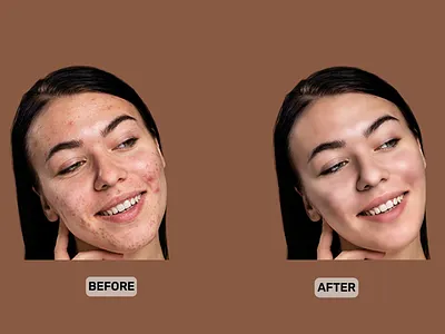 High End Retouching high end highend retouch highend retouching image editing photo photo edit photo retouch retouch retouching services