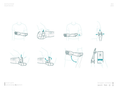 Prosthetic instructional illustrations illustration prosthesis prosthetics vector