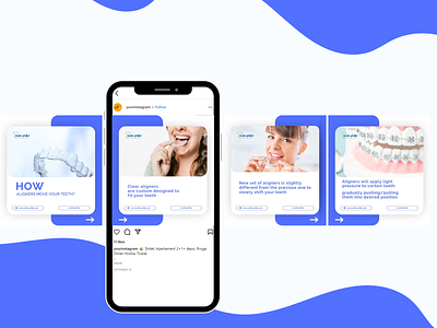 Social Media Post Design for Dental Clinic branding canva design graphic design illustration instagram instagram post instagram template social media design