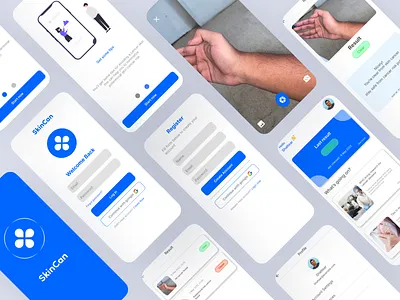 SkinCan - Skin Cancer Detection App app design graphic design illustration ui ux
