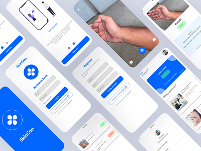 SkinCan - Skin Cancer Detection App app design graphic design illustration ui ux