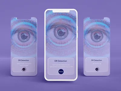 onboarding screen- diabetic retinopathy detection app design diabetes diabetic retinopathy eye home homescreens illustration medicalapp onboarding ui ux