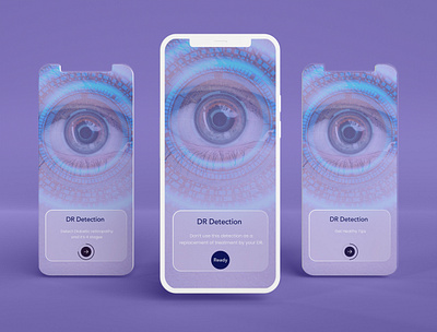 onboarding screen- diabetic retinopathy detection app design diabetes diabetic retinopathy eye home homescreens illustration medicalapp onboarding ui ux