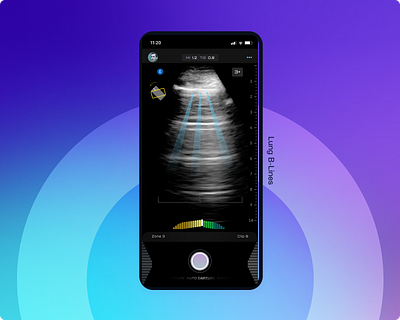 Ultrasound Prescriptive Guidance b lines device diagnostic experience imaging interface lung med tech ui ultrasound ux