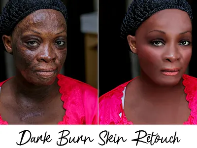 Dark Burn Skin Retouch adobe adobe photoshop background beautyphotography clean design dribbble editorial face fiverr freelancer graphic graphic design people photoretouching portrait poster rahat150 retouching