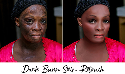 Dark Burn Skin Retouch adobe adobe photoshop background beautyphotography clean design dribbble editorial face fiverr freelancer graphic graphic design people photoretouching portrait poster rahat150 retouching