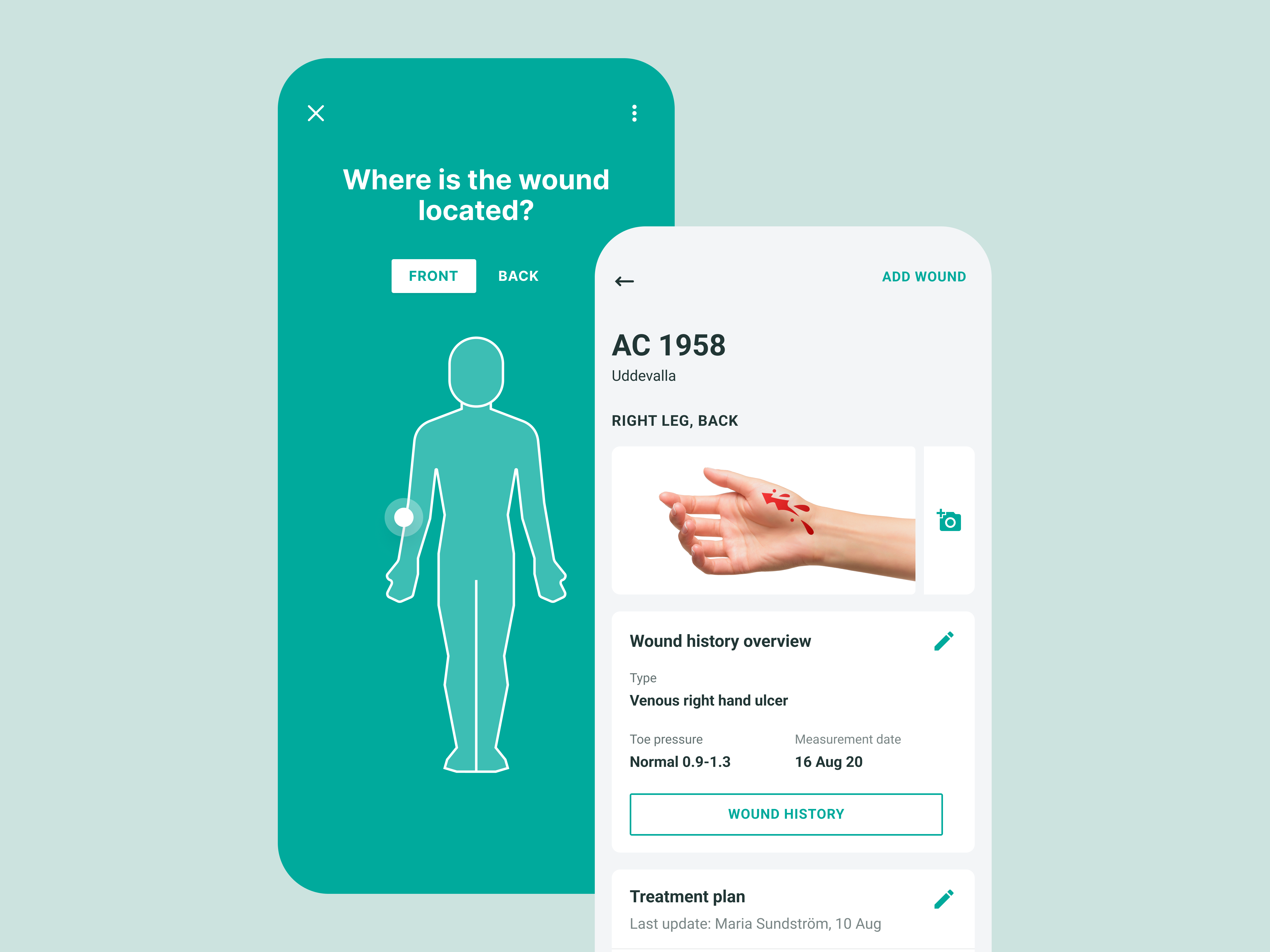 Example of OneWound - Mobile app supporting detection of infected wounds