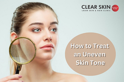 How to Treat an Uneven Skin Tone? skincare uneven skin uneven skin tone