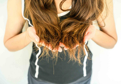 PCOS and Hair-loss: Can it be reversed? female pattern baldness pcos hairloss pcos system