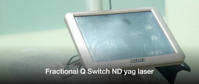 Q Switched NdYAG Laser Treatment Procedure, Before After Care skin treatment skincare