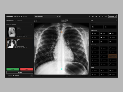 Medical imagery software dark mode imagery medical product product design redesign software ui x ray