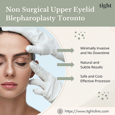 Upper Eyelid Blepharoplasty Toronto Using Tixel Medical Device