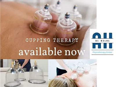 Cupping therapy branding cupping therapy physiotherapist physiotherapy sajzad digital