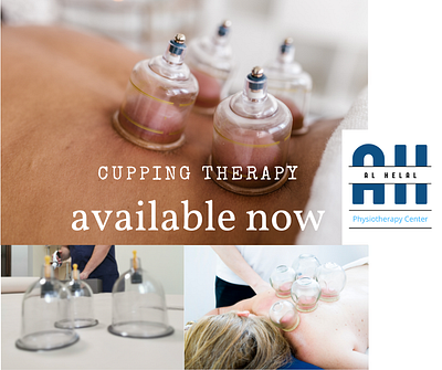 Cupping therapy branding cupping therapy physiotherapist physiotherapy sajzad digital
