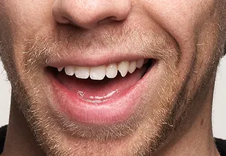Mounds of retouching face mouth person portrait