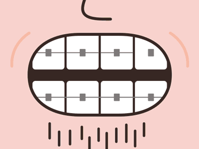 Adult Braces – Mini Game [Principle] app braces components drivers freebie game game design gif motion design prd principle teeth