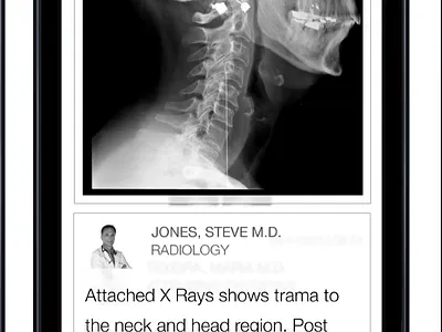 Mobile Product Design - HealthIT information architecture product design ui design ux design