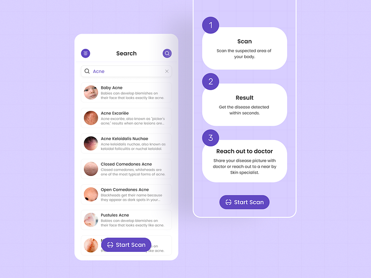 Dermat AI Skin Disease Scan App by 300Mind UI/UX for 300Mind on Dribbble