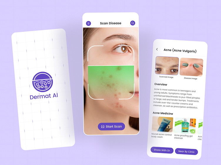 Dermat AI Skin Disease Scan App by 300Mind UI/UX for 300Mind on Dribbble