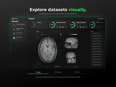 Explore datasets visually. artificial intelligence machine learning medical ui design web design