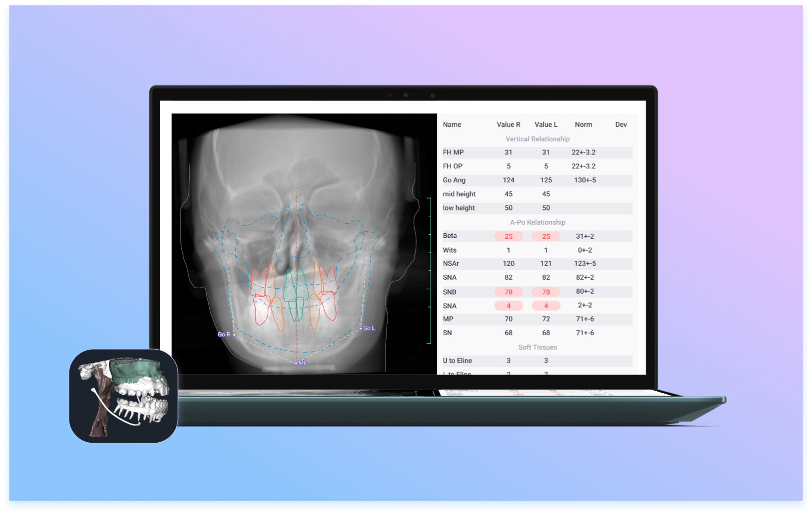 Cephalometry treatment plan 3d interface ui ux design user experience ux design web app web deisgn