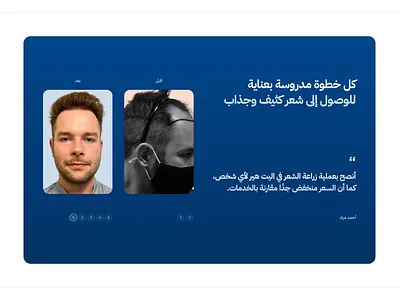 Elithair – Before and after before and after branding design illustration logo ui uiux user experience user interface userinterface ux