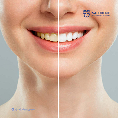 Saludent - Social Media branding dentist design graphic design illustration logo medic photograph socialmedia teeth vector