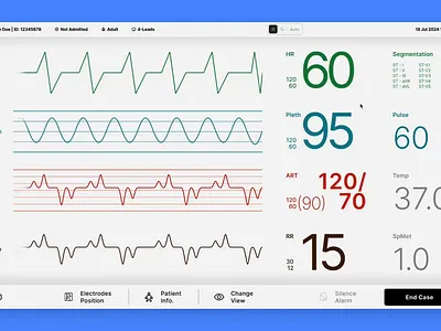 ECG monitor for Embedded World 2025 demo embedded embedded world figma gui iot medical medical devices prototype ui uxui