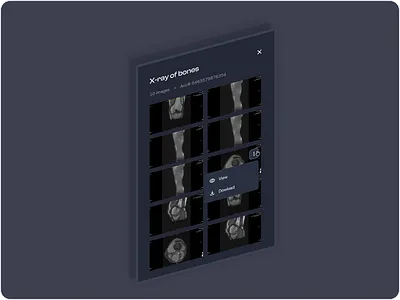 Medical Imaging Viewer X-ray 3dinterface ai clinicaltool ctscanviewer darkmodeux datavisualization design diagnostictool healthcareplatform healthtechui intuitivedesign medicaldashboard medicalimagingui minimalistdesign radiologyapp ui user experience ux uxui xrayviewer