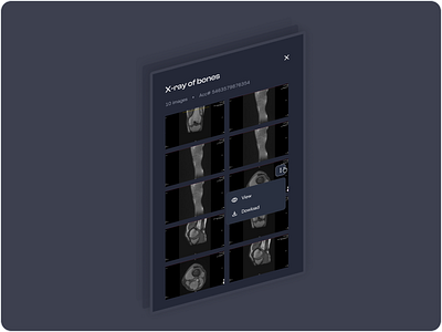 Medical Imaging Viewer X-ray 3dinterface ai clinicaltool ctscanviewer darkmodeux datavisualization design diagnostictool healthcareplatform healthtechui intuitivedesign medicaldashboard medicalimagingui minimalistdesign radiologyapp ui user experience ux uxui xrayviewer