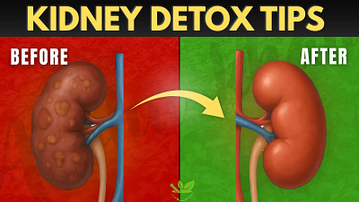 Kidney Detox Tips Youtube Thumbnail design graphic design graphicdesign thumbnail thumbnaildesign thumbnails youtube youtubedesign youtubethumbnaildesign youtubethumbnails