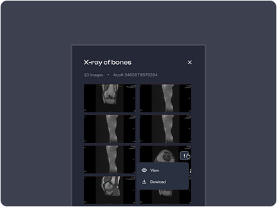 RadiologyViewer aiimaginginterface clinicaldarkui clinicaltooldesign darkmodehealthcare diagnostictoolux dicomstyleviewer downloadviewux medicalviewerui radiologistworkflow radiologyux radiologyviewer scanvaultexperience scanvaultui securemedicalui securescanaccess xrayimageviewer