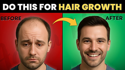 Hair Growth YouTube Thumbnail design graphic design graphicdesign thumbnail thumbnaildesign thumbnails youtube youtubethumbnail youtubethumbnaildesign