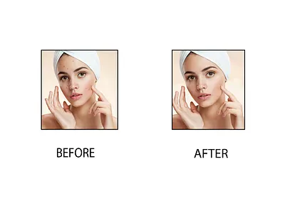 Pimples remove adobe illustrator adobe photoshop before and after image canva damage face dry skin pimples face graphic design oily skin pimples skin