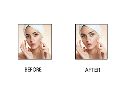 Pimples remove adobe illustrator adobe photoshop before and after image canva damage face dry skin pimples face graphic design oily skin pimples skin