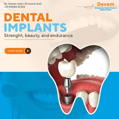 Social Media Post for Dental Clinic cosmetic dentistry social media dental care advertisement design dental clinic instagram post dental implant graphic design dental services creative dentist social media marketing implant dentist promotion modern dental branding orthodontic clinic marketing