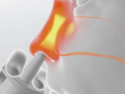 Rhinocort Nasal Allergy Relief 3d allergy relief animation helathy medical medicine motion graphics nasal nose rhinocort sick