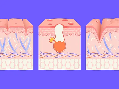 Skincare by Kotryna Zukauskaite for Curology anatomy cosmetics dermatologist dermatology health illustration illustrator product skin skin anatomy skin layers skin swatch skincare treatment vector wrinkle