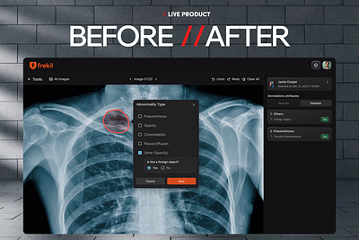 Medical Imaging Platform Redesign ai ai product ai saas app design artificial intelligence best design agency bottomlineux dashboard frekil healthcare imaging medical medtech product design saas design saasfactor y combinator yc