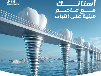 Strong Dental Foundations | Implant Concept Ad by Marklinica 3d animation graphic design