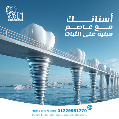 Strong Dental Foundations | Implant Concept Ad by Marklinica 3d animation graphic design