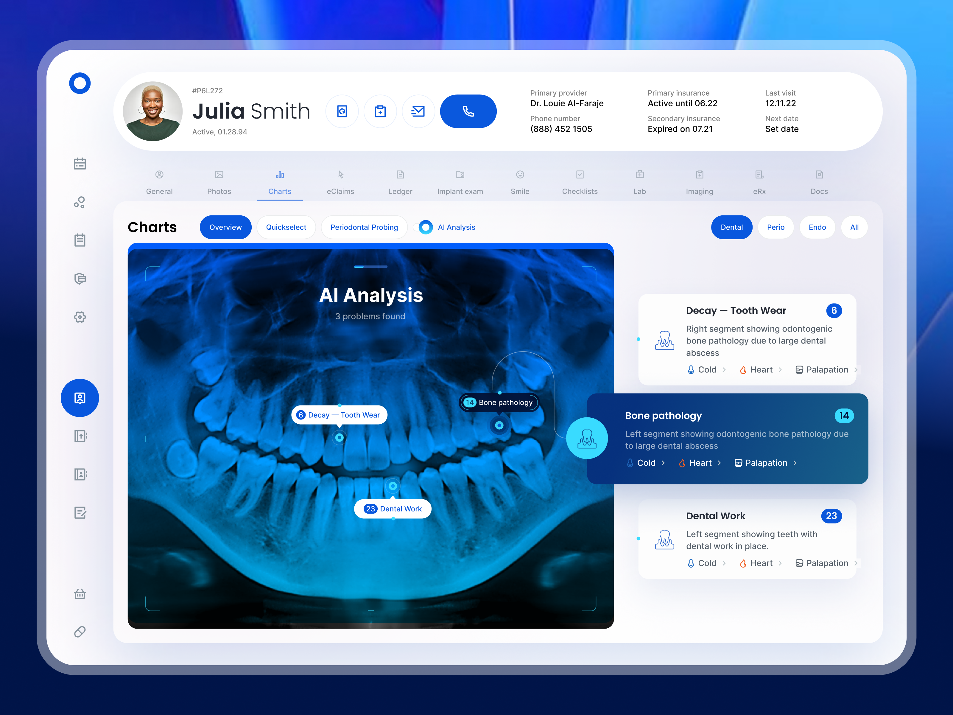 Example of Dental AI Dashboard - Panoramic X-ray & Assisted Diagnosis
