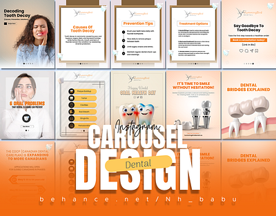 Dental Carosule Design carosule dental graphic design instagram