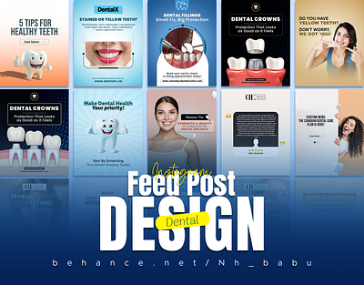 Dental Instagram Carousel Design 🦷 dental graphic design medical