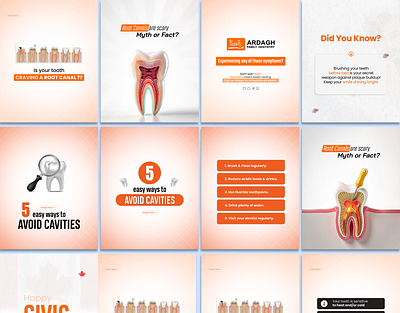 Dental Instagram Carousel Design 🦷 carousel clinic dental graphic design