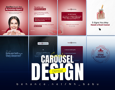 Dental Instagram Carousel Design 🦷 dental graphic design medical social media design