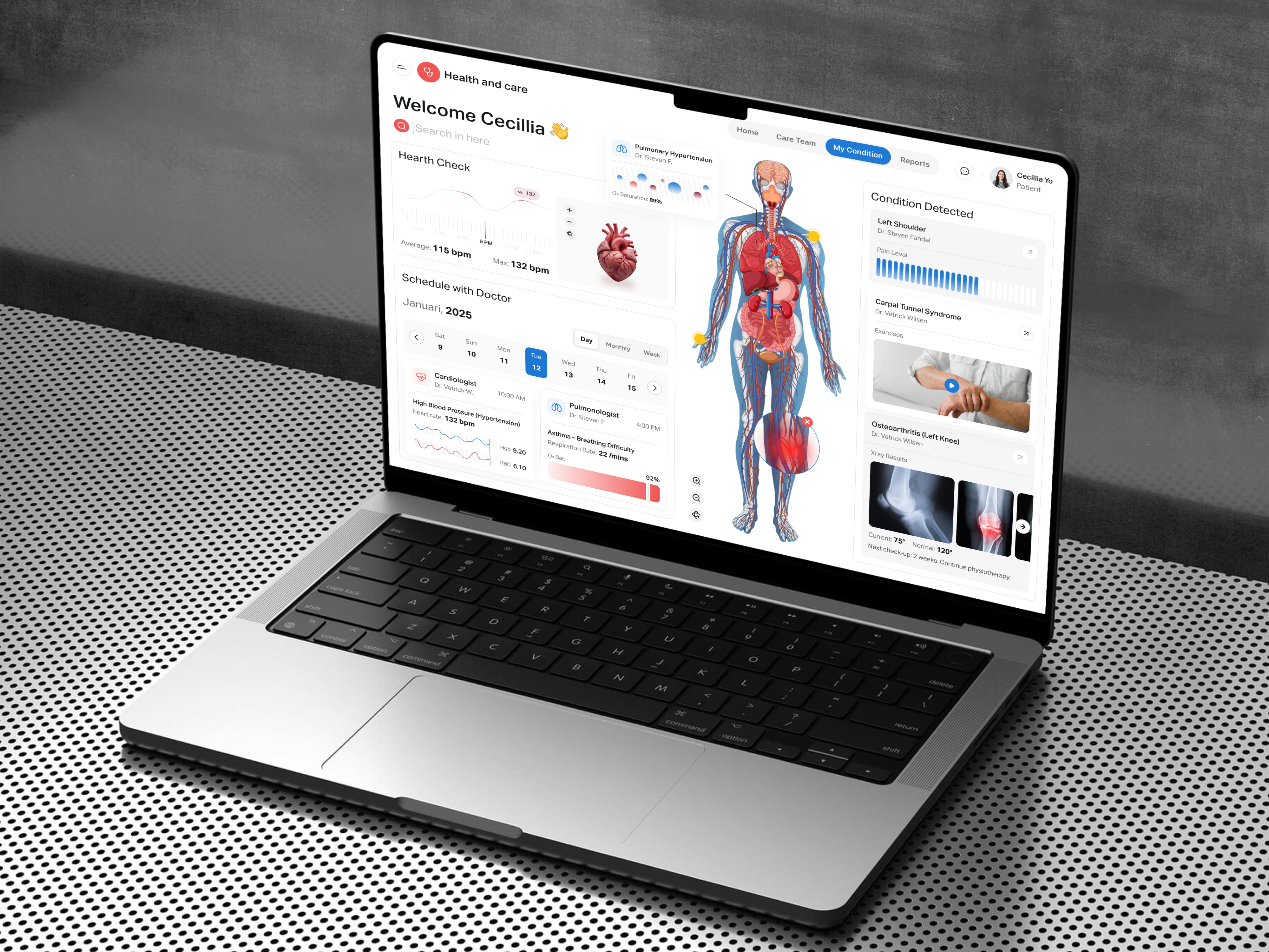 Example of Dashboard Design – 1 Custom Screen