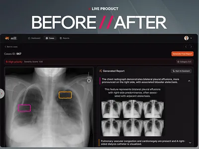 Redesigning AI-Powered Radiology Interface ai copilot best design agency best product design agency best ux designer on dribbble bottomlineux ct scan dark mode imaging mafruh mecha health medical tech neorology radiology saas saas design agency saasfactor sohag ux design y combinator